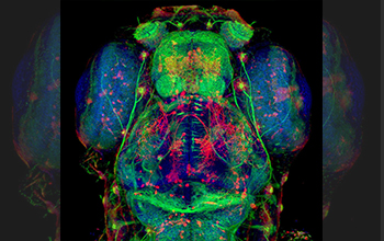 Confocal microscopy image of nerve fibers in zebrafish brain