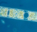 Close-up image of a diatom, which contains symbiotic bacteria that take nitrogen from the air.