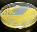 Photo of a petri plate containing bacteria harvested from amoebae.