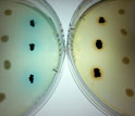 colonies of superoxide-producing bacteria growing on laboratory plates with dye