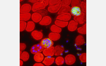 Photo showing red blood cells infected with malaria parasites (cell nucleus in blue).
