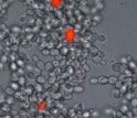 snowflake yeast with dead cells stained red.