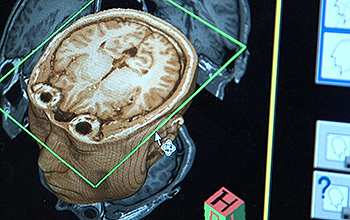 Three-dimensional image of the brain