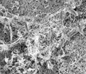 Electron micrograph of bacteria biofilm.