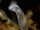 a bdelloid rotifer