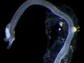 a male Osedax priapus (bone worm)