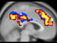 image showing brain activity