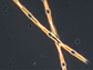 view of domoic acid producing Pseudo-nitzschia diatom