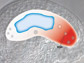 a plant ovule enclosing an embryo sac