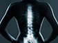 x-ray image of a human spine