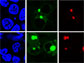 different proteins (red, green) within the cell (blue)
