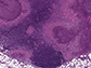 mice infected with the bacteria Yersinia pseudotuberculosis form granulomas