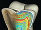 a molar tooth model