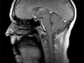 MRI of a brain