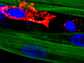 Macrophages (red) within an engineered skeletal muscle tissue disrupted along mature, contractile myofibers (green)