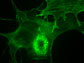 rosettes inside cancer-associated fibroblasts