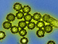 microscopic image of H1N1 influenza virus particles