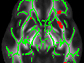News thumbnail of brain MRI